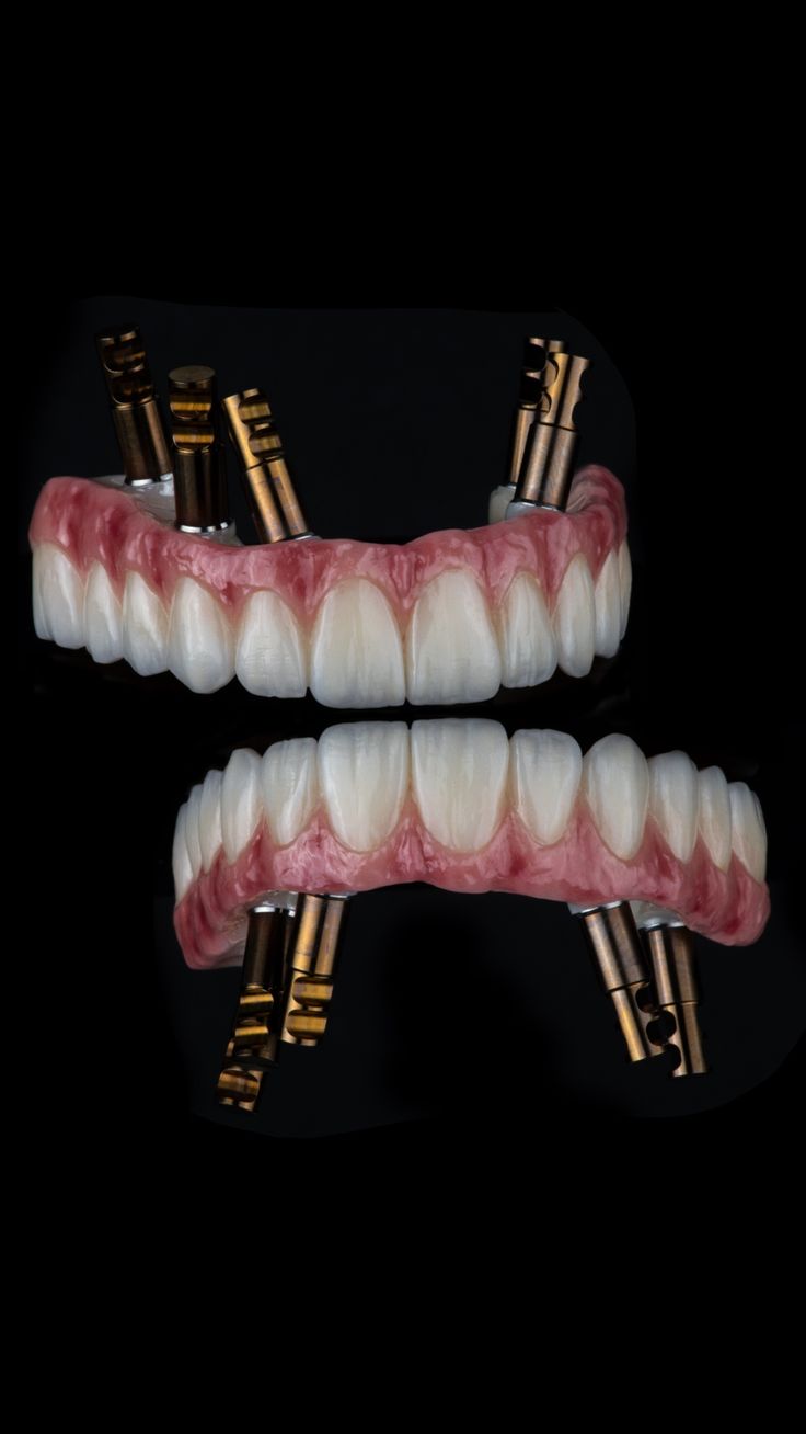 Full arch zirconia restoration produced by PRAXIS MILL
