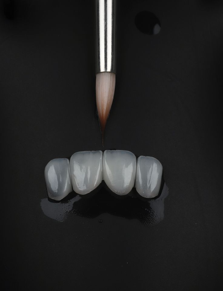 Zirconia crowns